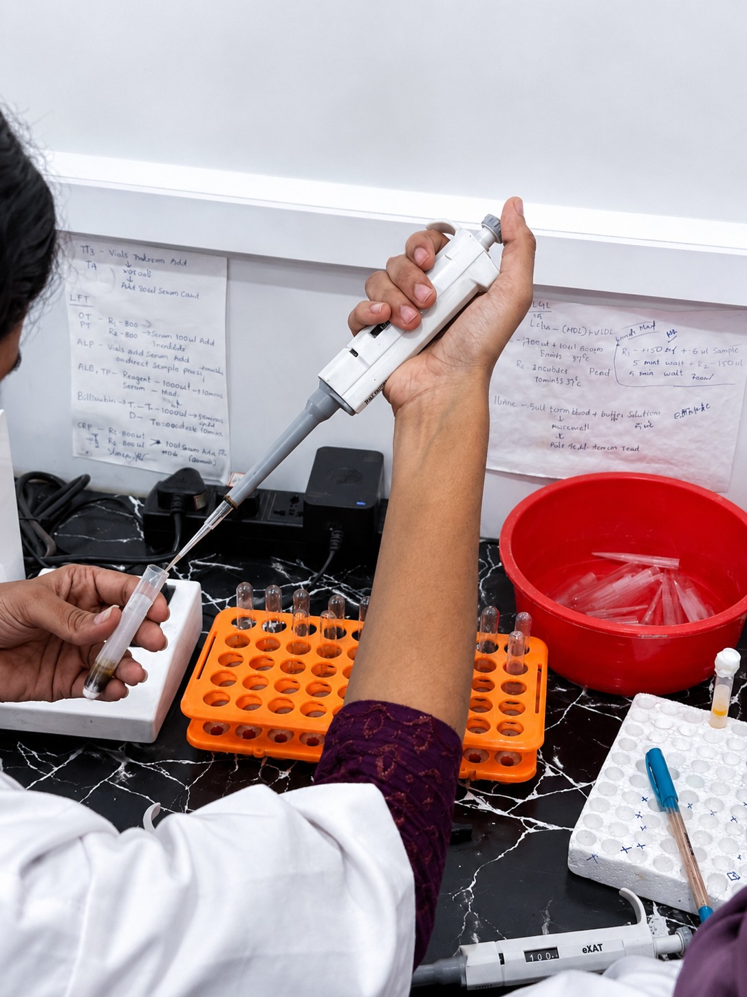 Lab technician using pipette for blood test sample preparation at ARD Health Care diagnostic lab in Nenmara Palakkad